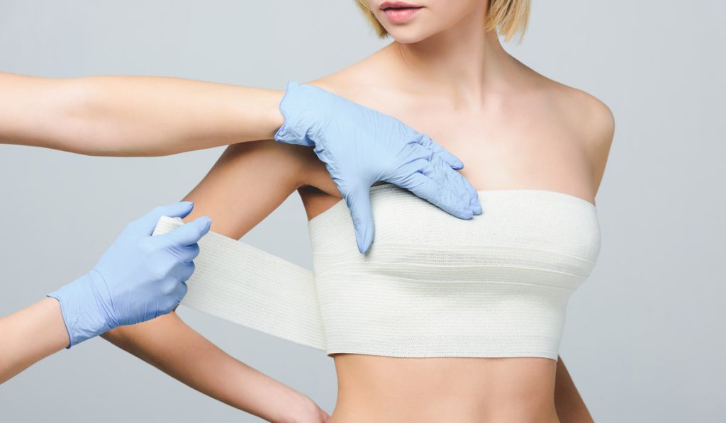 Brustvergrößerung mit Straffung: Die Rolle von Implantaten und Eigenfett