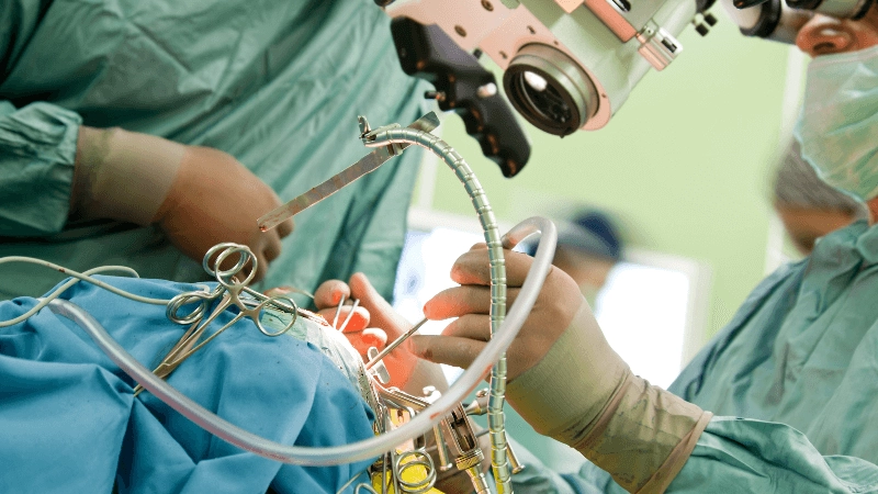 Warum die Türkei führend in der Schlauchmagen Türkei Chirurgie ist